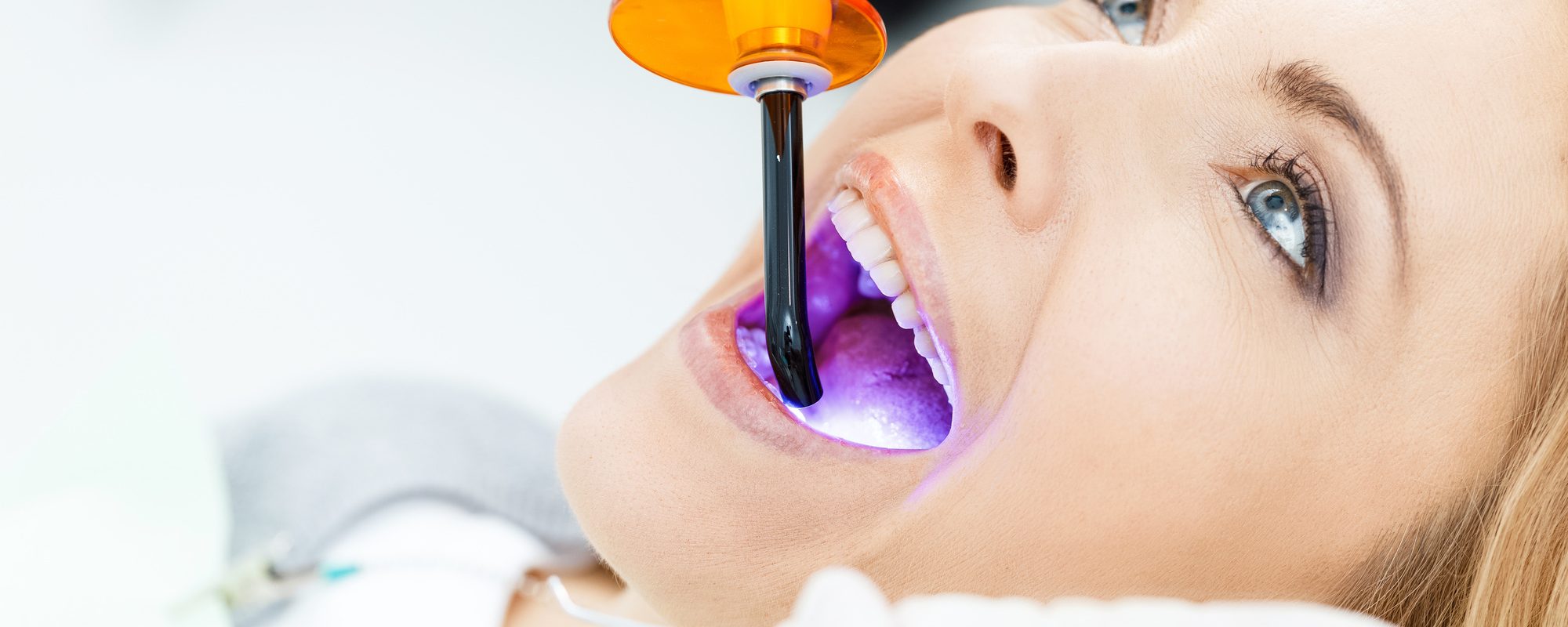 Close-up partial view of dentist using dental curing UV lamp on teeth of patient teeth whitening thousand oaks