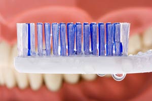 denture cleaning denture cleaning