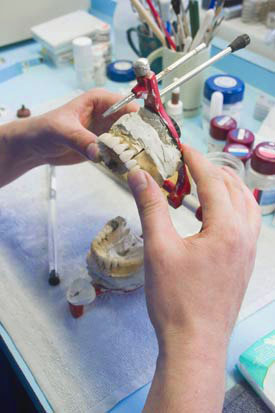 dentures rebase and repairs dentures rebase and repairs