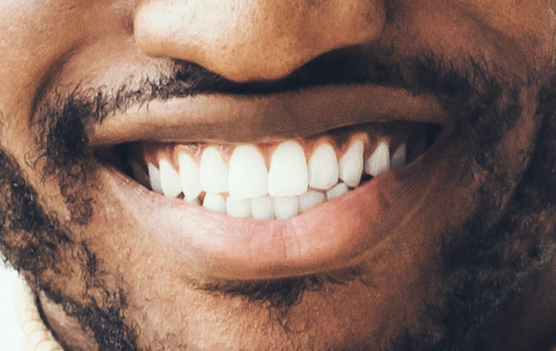 teeth whitening smile thousand oaks dental teeth whitening smile thousand oaks dental