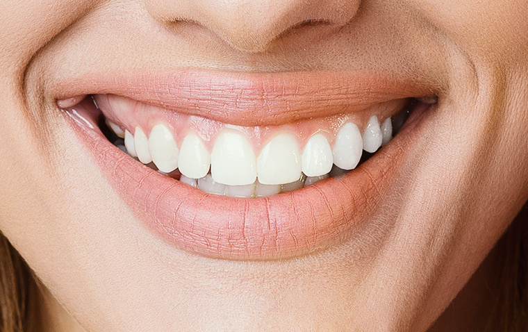 zoom teeth whitening thousand oaks zoom teeth whitening thousand oaks